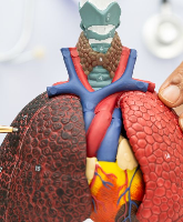 Czy obecne kryteria screeningu raka płuca wykluczają 2/3 pacjentów?